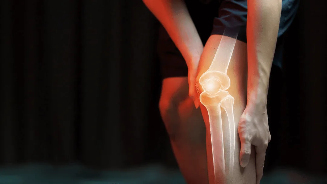 Can Volleyball Cause Knee Pain?